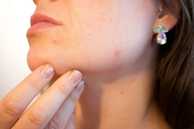 Te zmiany skórne warto pokazać dermatologowi!